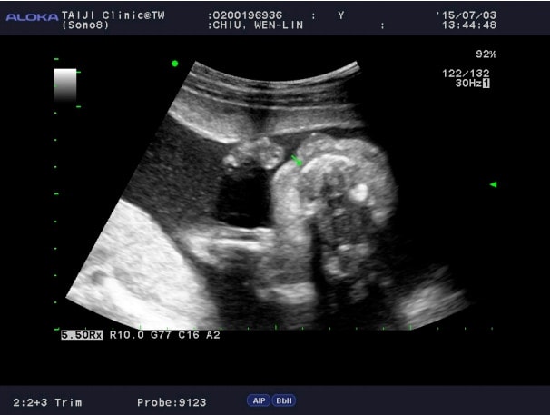 關於水果妹之來吃三寶飯 - 第2張圖 關於水果妹之來吃三寶飯