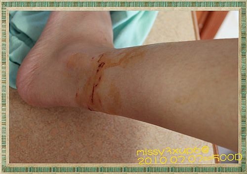 【傷心】桓爸的小老婆受傷了ＱＱ