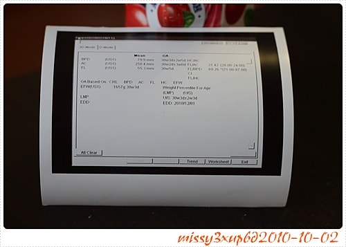 【玳瑁】30W+3D 超音波微笑的小子