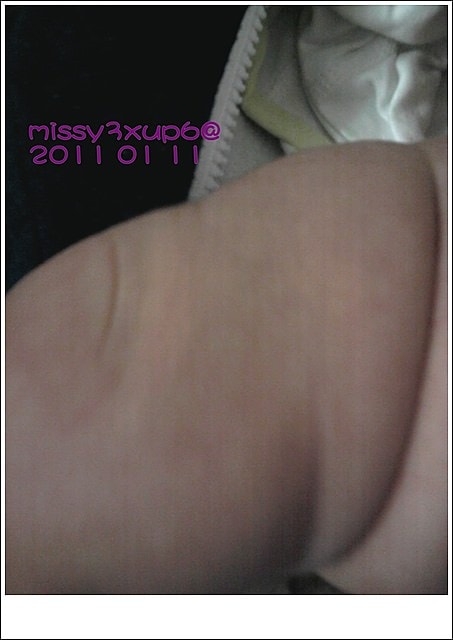 【愷愷】打五合一加二月健檢 - 第2張圖 【愷愷】打五合一加二月健檢