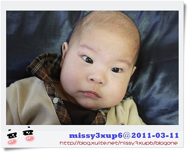 【愷愷】對付異位性皮膚炎，益生菌真有效