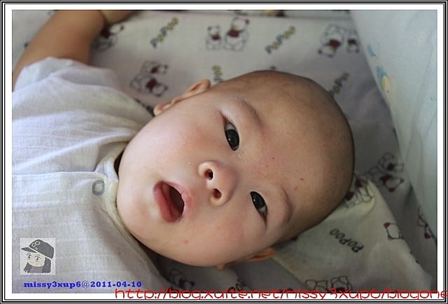 【愷愷】4m30d令人心疼，時好時壞的皮膚