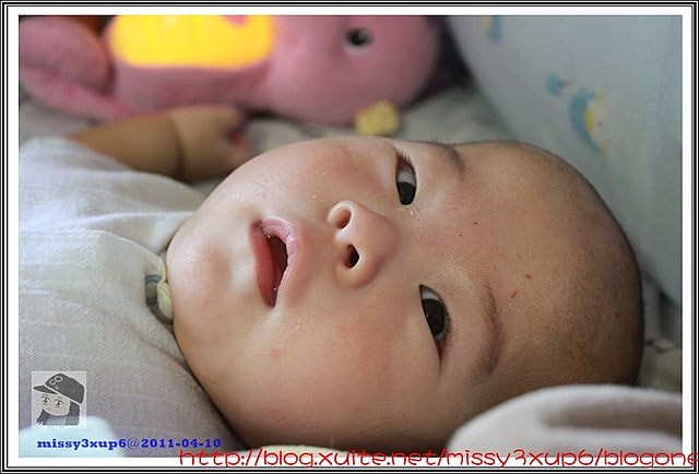 【愷愷】4m30d令人心疼，時好時壞的皮膚