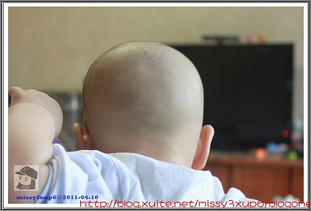 【愷愷】4m30d令人心疼，時好時壞的皮膚