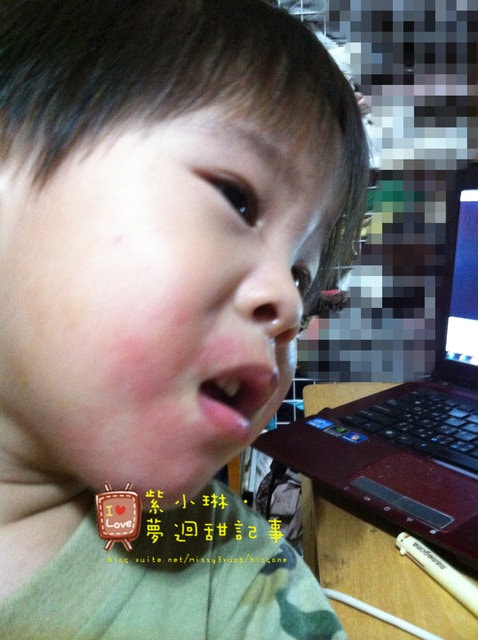 愷兒的嬰兒肌@紅紅通通不見了!!!!!