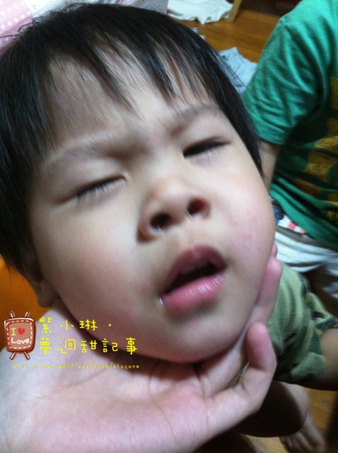愷兒的嬰兒肌@紅紅通通不見了!!!!!