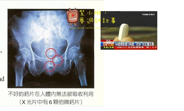 [保養] 鈣要通電，吃了才有效?